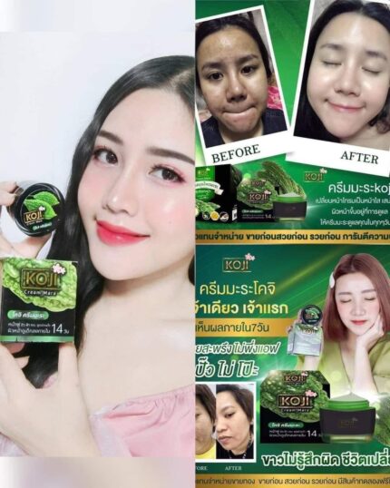 Koji Cream Mara – Kojic Acid Skin Brightening Cream